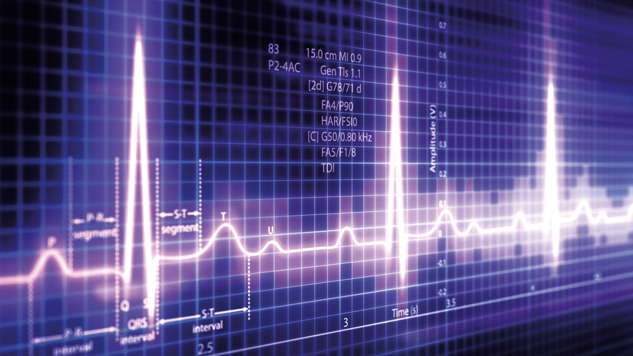 ecg-trace-centre